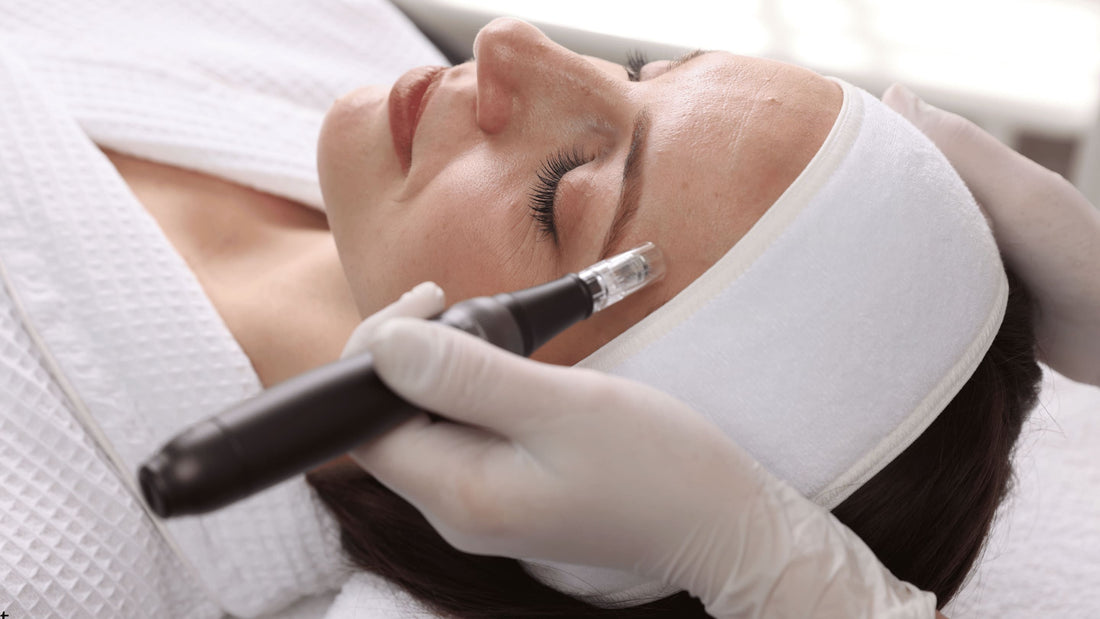 Microneedling med Dr. Pen dermaroller i ansiktet.