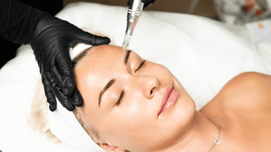Microneedling-behandling i ansiktet med dermapen och PRP