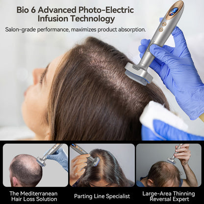 Bio Pen Bio 6 usado no tratamento de queda de cabelo com tecnologia avançada de infusão fotoelétrica, mostra aplicação profissional para estimular o crescimento capilar e melhorar a absorção do produto em áreas com cabelo fino.