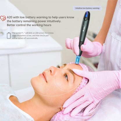 Terapeuta de pele realizando microneedling com Dr. Pen A20 na testa de um cliente, com aviso de bateria baixa exibido e áreas de tratamento marcadas para tratamento facial profissional.