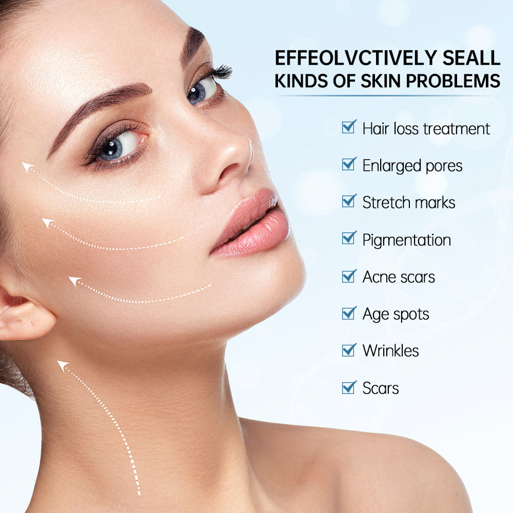 Mulher mostrando os resultados de microneedling para tratamento de problemas de pele como poros dilatados, cicatrizes, cicatrizes de acne, manchas de pigmentação, rugas e linhas finas.